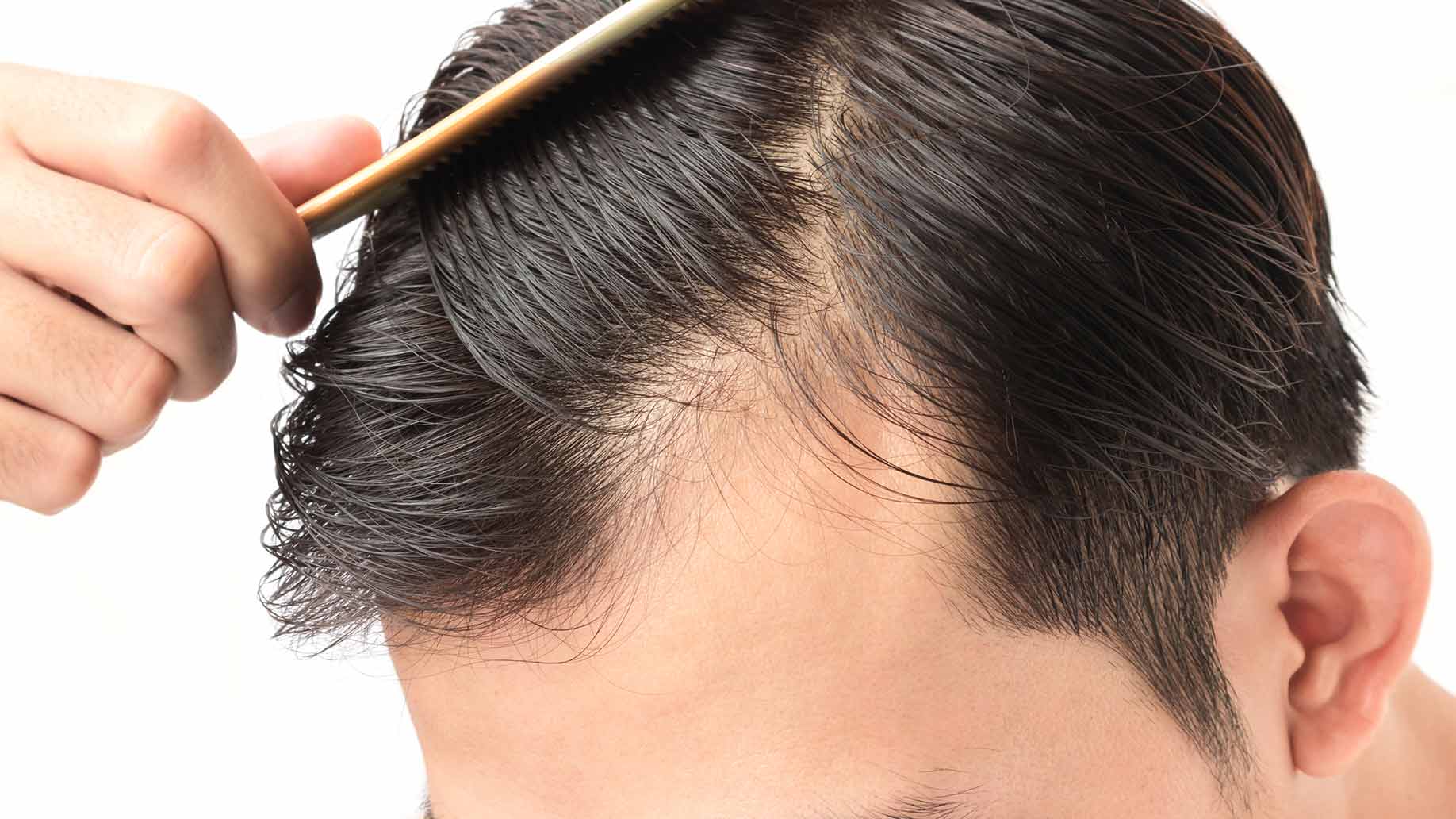How To Reduce Hair Loss In Men The Cook Book