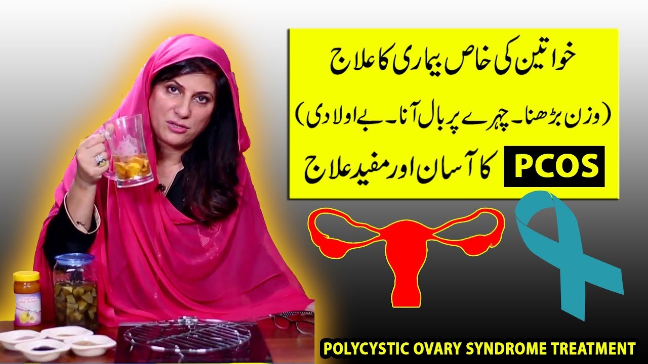 Best Natural Treatment for PCOS PCOD Polycystic ovary syndrome 